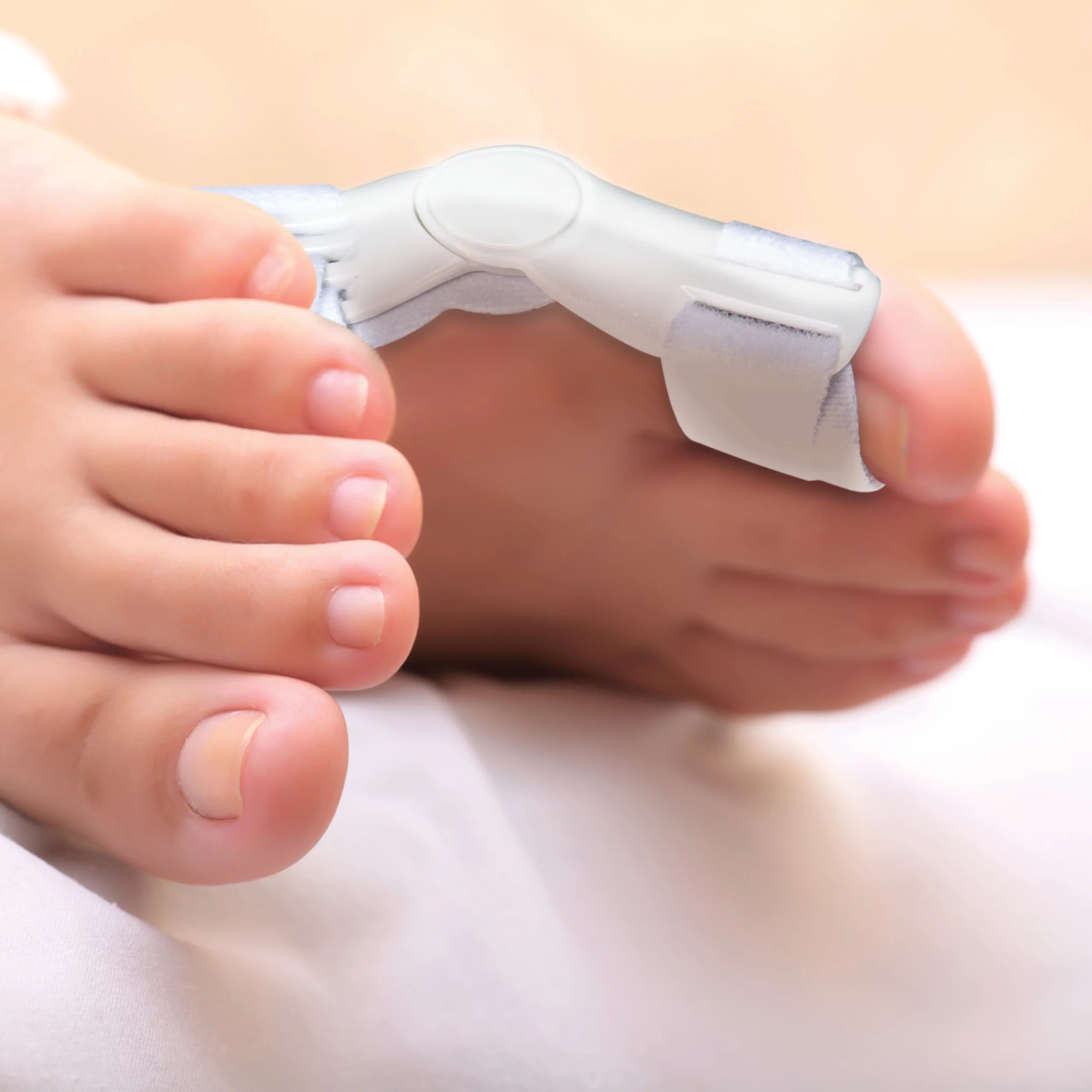 Day/Night Toe Alignment Splint | 386